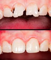 Dr Ang’s Templestowe Dentist image 5