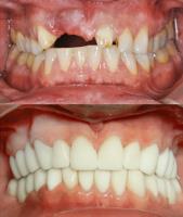 Dr Ang’s Templestowe Dentist image 4