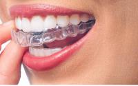 Traditional Metal Braces - Best Smile Orthodontist image 3