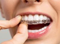 Traditional Metal Braces - Best Smile Orthodontist image 2