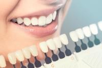 Traditional Metal Braces - Best Smile Orthodontist image 6