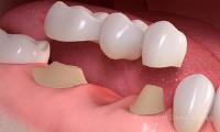 Sparkling Dental image 2