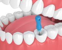 Sparkling Dental image 5