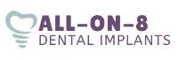 All-On-8 Dental Implants image 5