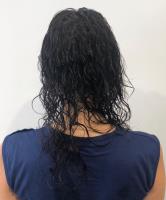 CRLab Australia - Hair Loss Scalp Clinic image 4