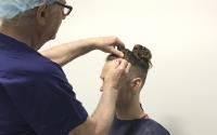 MediHair - Best Hair Loss Transplant in Melbourne image 7