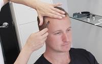 MediHair - Best Hair Loss Transplant in Melbourne image 4