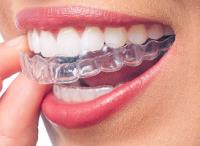 My Smile Doctors - Dentist parramatta image 13