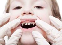 My Smile Doctors - Dentist parramatta image 11