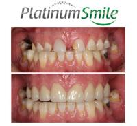 Platinum Smile Dentist Mandurah image 2