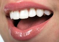 Prosmiles Dental Studio - Dentist Collingwood image 8