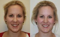 Cosmetic & Laser Dentistry Centre image 2