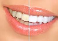 Cosmetic & Laser Dentistry Centre image 3