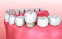 Woodleigh Waters Dental Surgery, Berwick image 2