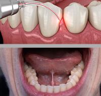 Campsie Laser Dental image 4