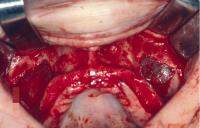 Illawarra Oral and Maxillofacial Surgery image 1
