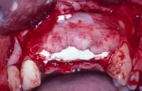 Illawarra Oral and Maxillofacial Surgery image 2