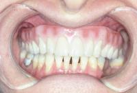 Illawarra Oral and Maxillofacial Surgery image 5