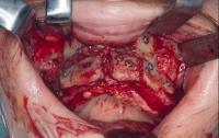 Illawarra Oral and Maxillofacial Surgery image 6