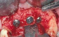 Illawarra Oral and Maxillofacial Surgery image 4
