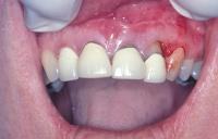 Illawarra Oral and Maxillofacial Surgery image 7