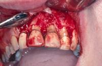 Illawarra Oral and Maxillofacial Surgery image 9