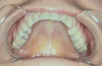 Illawarra Oral and Maxillofacial Surgery image 10