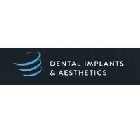 Dental Implants & Aesthetics image 1