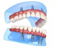 Advanced Dental Implants Institute image 2