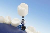 Blue Spa Dental image 3