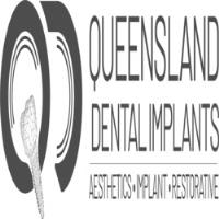 Queensland Dental Implants image 1
