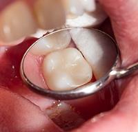 Killoran Dental image 6