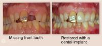 Putney Dental Care image 5