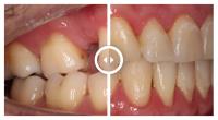 Gentle Dental Hawthorn image 9