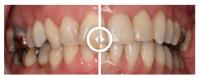 Gentle Dental Hawthorn image 8