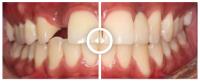 Gentle Dental Hawthorn image 12