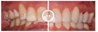 Gentle Dental Hawthorn image 2