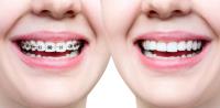New Smile Dental Preston image 1