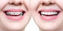 New Smile Dental Preston logo