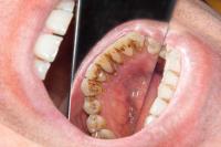 Goldfields Family Dental image 2