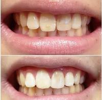 Crystal Dental Clinic image 3