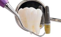 Dental Implant Professionals image 2