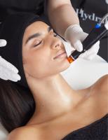 Hydrafacial Australia image 2