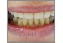 Direct Denture Care image 4
