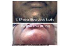 EPIness Electrolysis Studio image 5