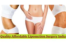 Cosmetic and Obesity Surgery Hospital India image 5