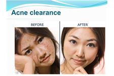 Clearskincare Clinics image 3