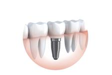 Dr Paulo Pinho Oral Surgery Clinic image 2