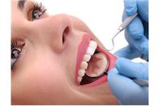 UC Dental - Gold Coast Dentists image 8