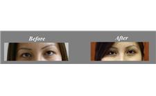 Advance Beauty Cosmetic Surgery- Sydney, NSW image 4